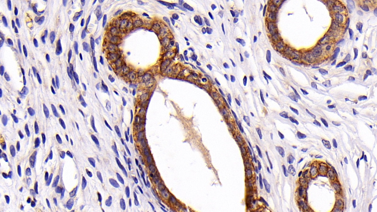 Polyclonal Antibody to Keratin 3 (KRT3)