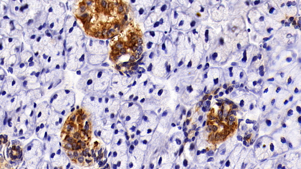 Polyclonal Antibody to Keratin 3 (KRT3)