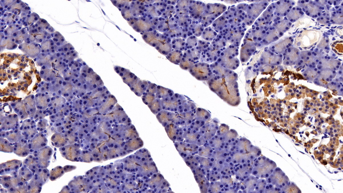 Polyclonal Antibody to Keratin 3 (KRT3)