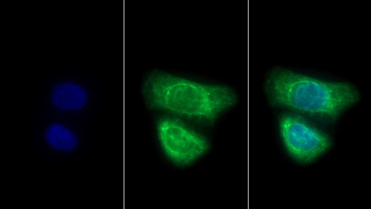 Polyclonal Antibody to Keratin 3 (KRT3)