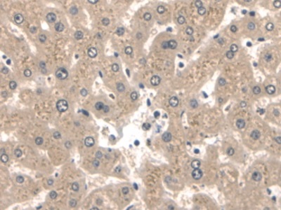 Polyclonal Antibody to Keratin 2 (CK2)