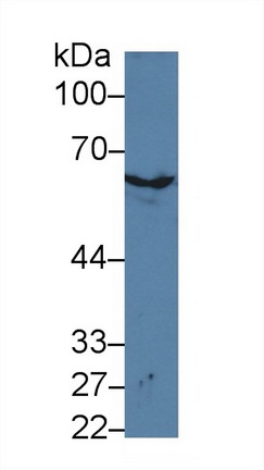 Polyclonal Antibody to Keratin 2 (CK2)