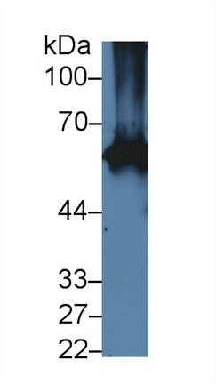 Polyclonal Antibody to Keratin 2 (CK2)