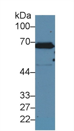 Polyclonal Antibody to Keratin 2 (CK2)