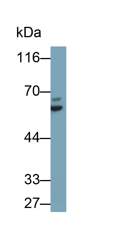 Polyclonal Antibody to Keratin 2 (CK2)