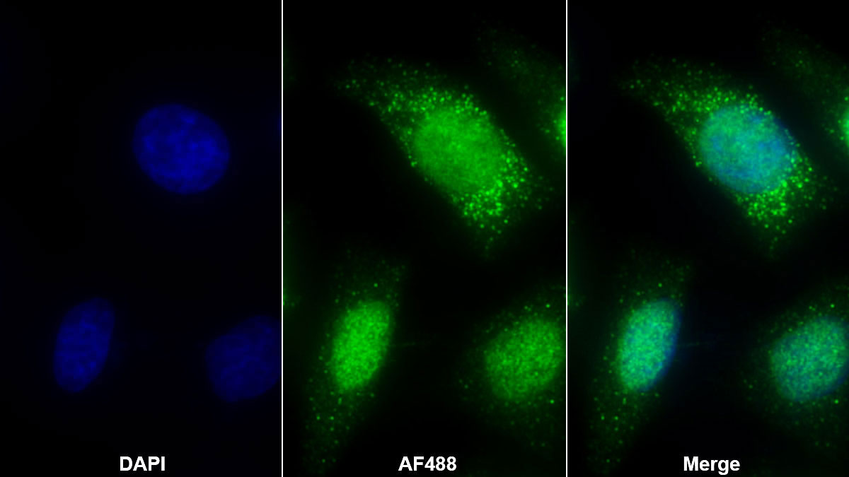 Polyclonal Antibody to Cytokeratin 1 (CK1)