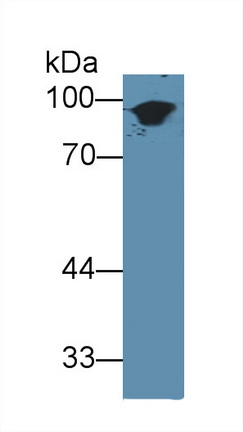 Polyclonal Antibody to Cytokeratin 1 (CK1)