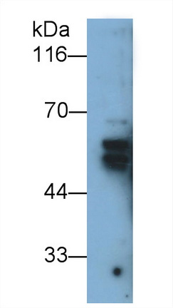 Polyclonal Antibody to Cytokeratin 1 (CK1)