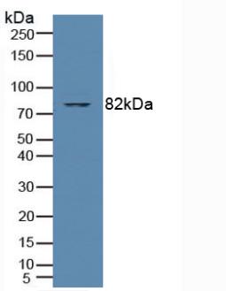 Polyclonal Antibody to Protein Kinase C Theta (PKCq)