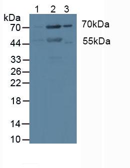 Polyclonal Antibody to Protein Kinase C Iota (PKCi)