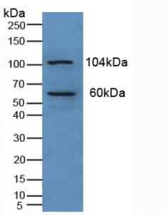 Polyclonal Antibody to Protein Kinase N1 (PKN1)