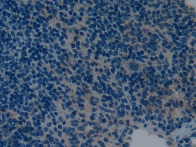 Polyclonal Antibody to Natriuretic Peptide Precursor B (NPPB)