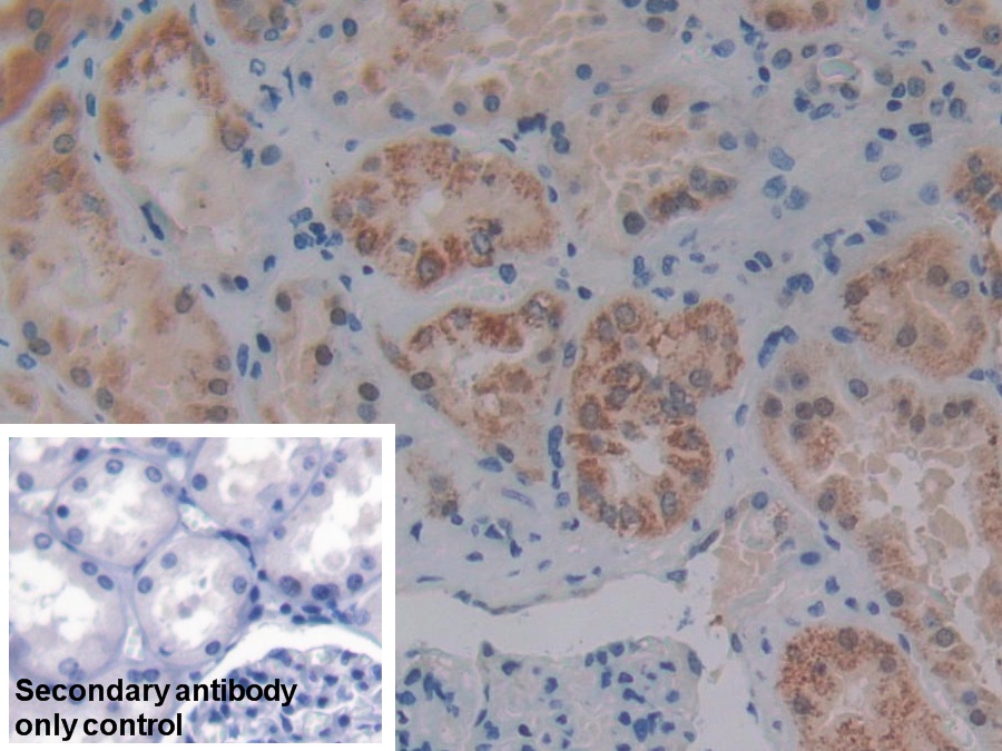 Polyclonal Antibody to Protein Kinase D1 (PKD1)