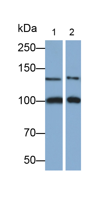 Polyclonal Antibody to Protein Kinase D2 (PKD2)