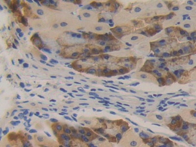 Polyclonal Antibody to Protein Kinase D2 (PKD2)