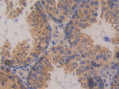 Polyclonal Antibody to Protein Kinase D2 (PKD2)