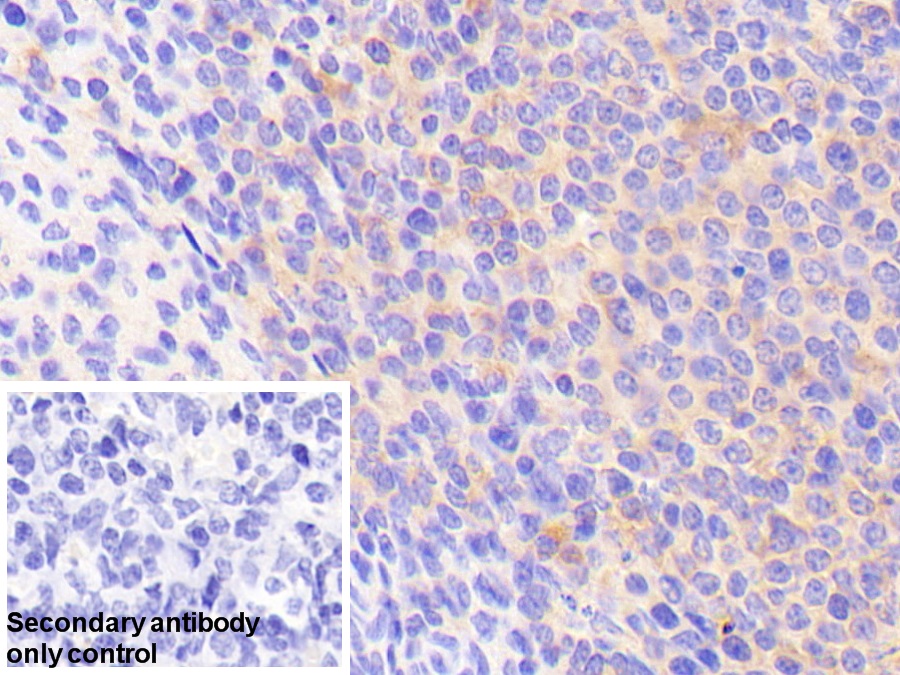 Polyclonal Antibody to Fibrinogen Like Protein 2 (FGL2)