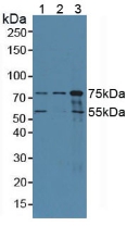 Polyclonal Antibody to Coilin (COIL)