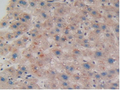 Polyclonal Antibody to Coilin (COIL)