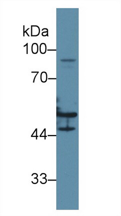 Polyclonal Antibody to Cytokeratin 16 (CK16)