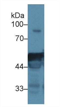 Polyclonal Antibody to Cytokeratin 16 (CK16)