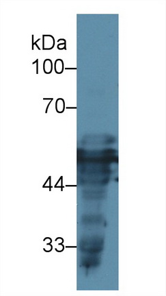 Polyclonal Antibody to Cytokeratin 16 (CK16)