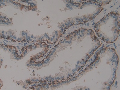 Polyclonal Antibody to Cytokeratin 16 (CK16)