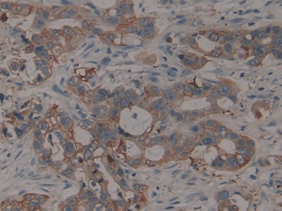 Polyclonal Antibody to Cytokeratin 16 (CK16)