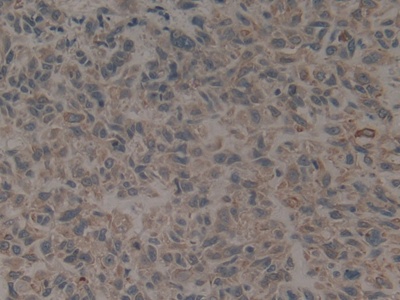 Polyclonal Antibody to Cytokeratin 16 (CK16)