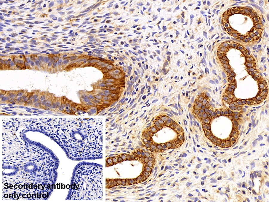 Polyclonal Antibody to Cytokeratin 16 (CK16)