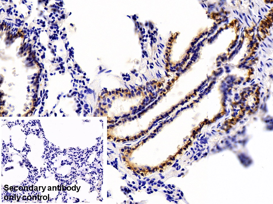 Polyclonal Antibody to Cytokeratin 16 (CK16)