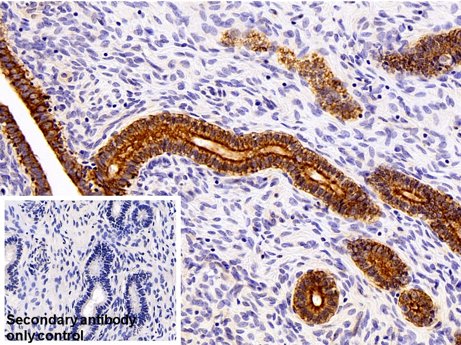 Polyclonal Antibody to Cytokeratin 16 (CK16)