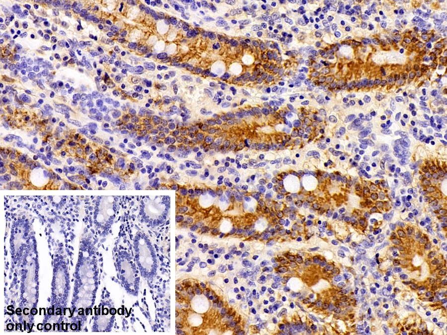 Polyclonal Antibody to Cytokeratin 16 (CK16)