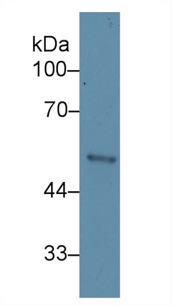 Polyclonal Antibody to Cytokeratin 15 (CK15)