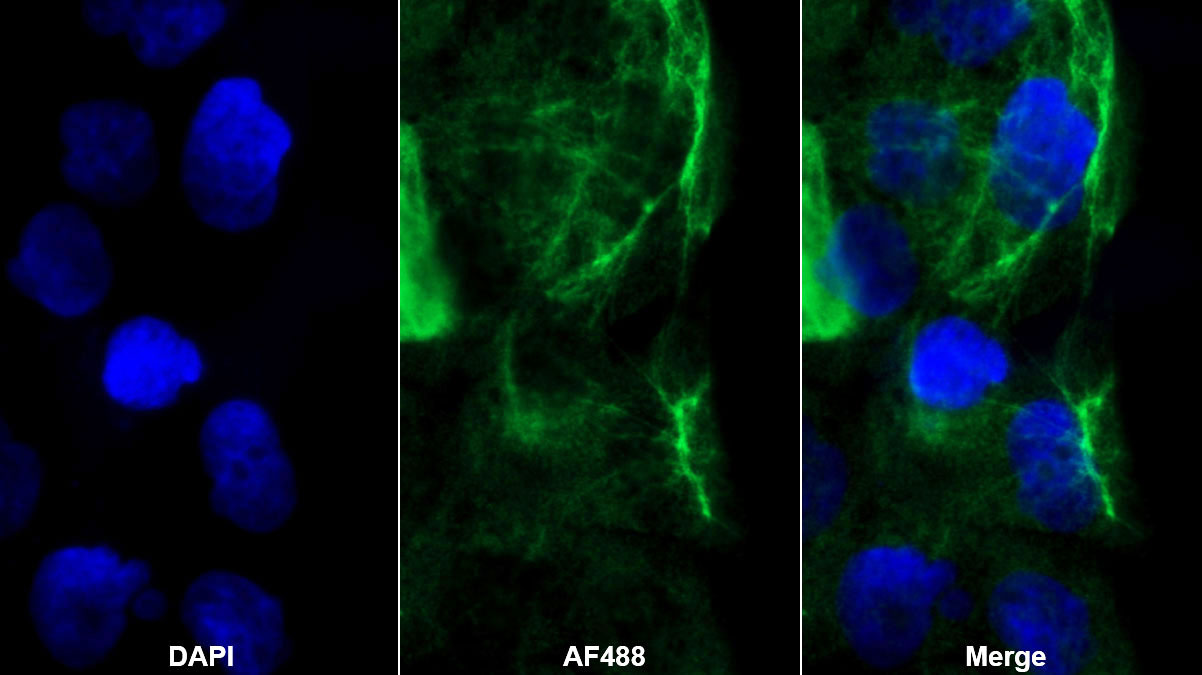 Polyclonal Antibody to Cytokeratin 15 (CK15)