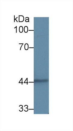 Polyclonal Antibody to Cytokeratin 15 (CK15)