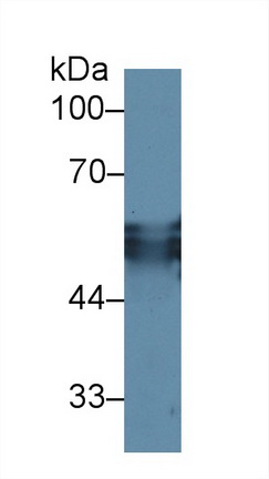 Polyclonal Antibody to Cytokeratin 15 (CK15)