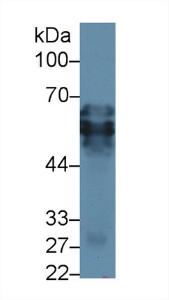 Polyclonal Antibody to Cytokeratin 15 (CK15)