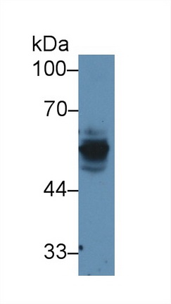 Polyclonal Antibody to Cytokeratin 15 (CK15)