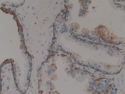 Polyclonal Antibody to Cytokeratin 15 (CK15)