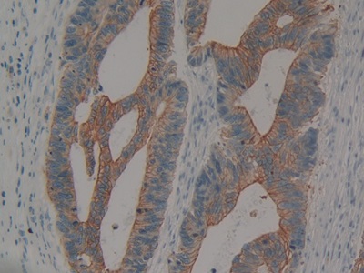 Polyclonal Antibody to Cytokeratin 15 (CK15)