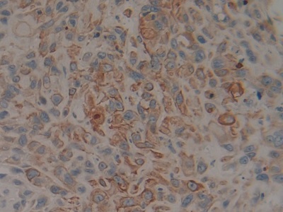 Polyclonal Antibody to Cytokeratin 15 (CK15)