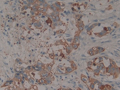 Polyclonal Antibody to Cytokeratin 15 (CK15)