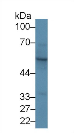 Polyclonal Antibody to Cytokeratin 15 (CK15)