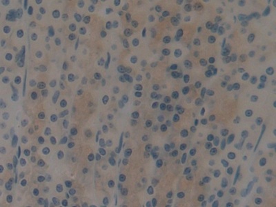 Polyclonal Antibody to Cytokeratin 15 (CK15)