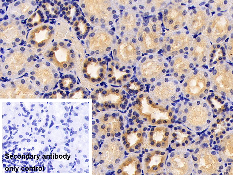 Polyclonal Antibody to Apolipoprotein A1 (APOA1)