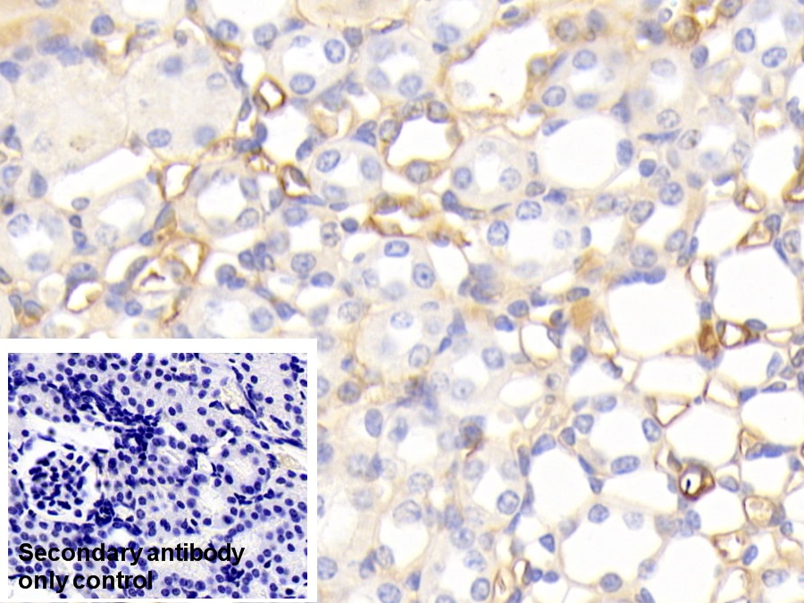 Polyclonal Antibody to Apolipoprotein A1 (APOA1)