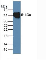 Polyclonal Antibody to Cytokeratin 14 (CK14)