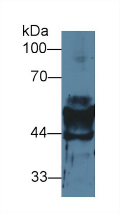 Polyclonal Antibody to Cytokeratin 14 (CK14)