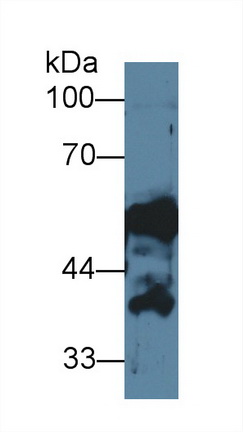 Polyclonal Antibody to Cytokeratin 14 (CK14)